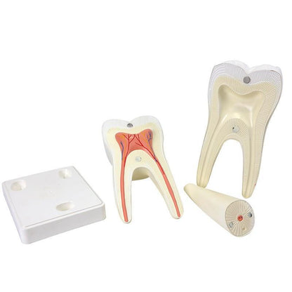 Huge Molar Dental Model