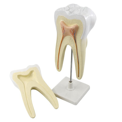 Huge Molar Dental Model